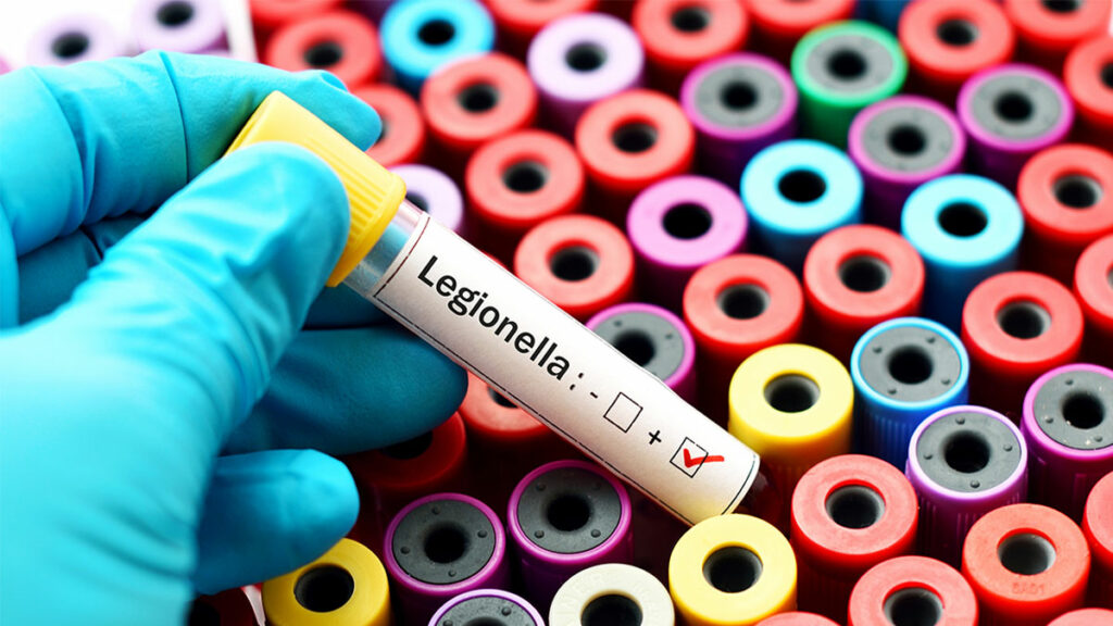 How To Test for Legionella in Water